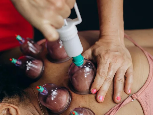 Des ventouses préparées pour une séance traditionnelle